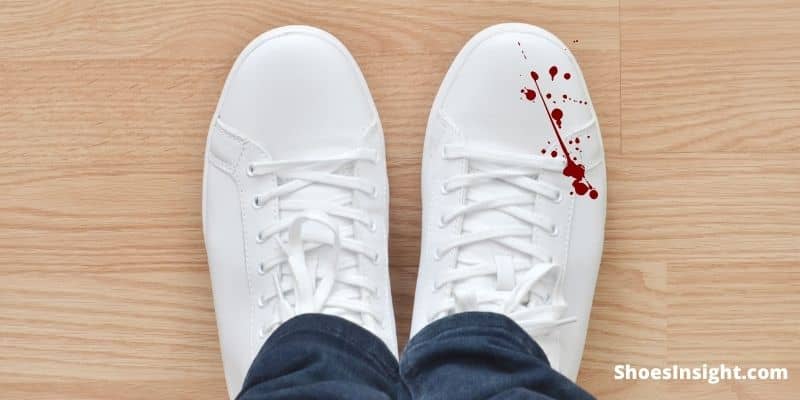 7 Effective Ways on How to Get Blood Out of White Shoes?