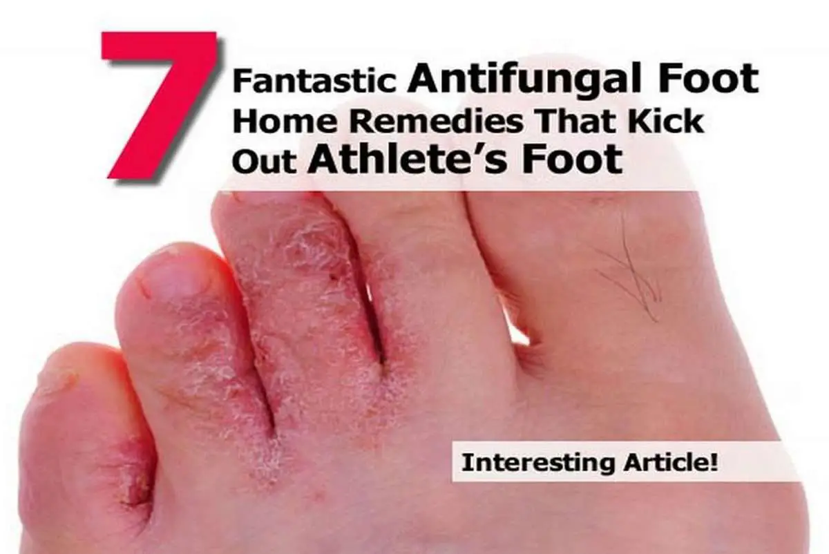 7 Fantastic Antifungal Foot Home Remedies That Kick Out ...