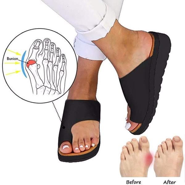 Do you have Bunions? The Comfy Bunion Correcting Sandals are engineered ...
