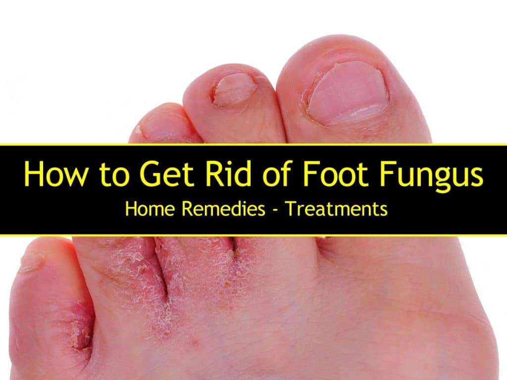 How to Get Rid of Foot Fungus
